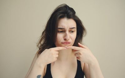 Trądzikowa mapa twarzy i jej znaczenie dla zdrowia